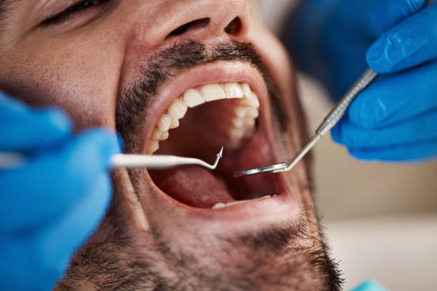 Best Emergency Treatment for Dental Infections or Abscesses in Schoolcraft, MI